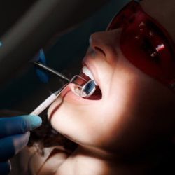 What Are the Different Root Canal Options Available Today?