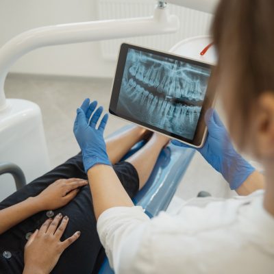 Dental Implant Care: Five Ways to Keep Them in Good Condition