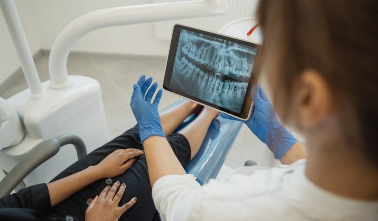 Dental Implant Care: Five Ways to Keep Them in Good Condition