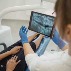 Dental Implant Care: Five Ways to Keep Them in Good Condition