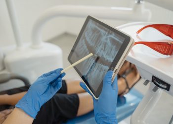 How to Properly Care For Your Dentures