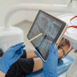 How to Properly Care For Your Dentures
