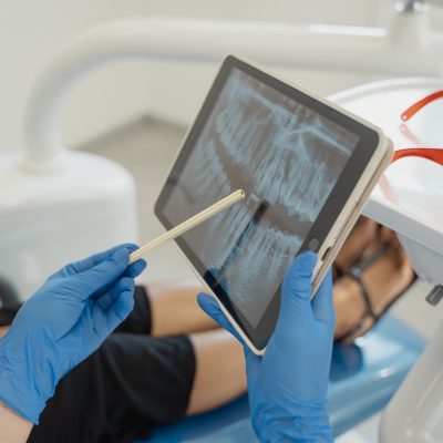 How to Properly Care For Your Dentures