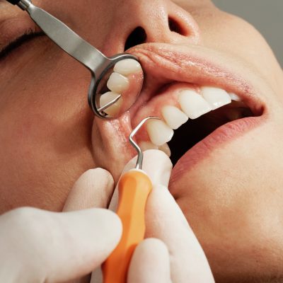 Revolutionize Your Smile: Top Cosmetic Dentistry Solutions for Common Dental Concerns