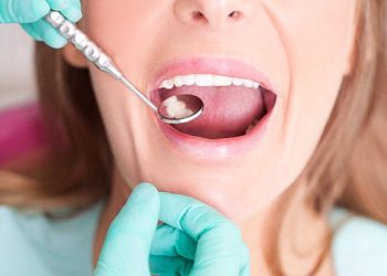 Cost-Effective Cosmetic Dentistry: Affordable Options for a Beautiful Smile