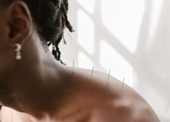 How Does Acupuncture Work and What Are Its Benefits?
